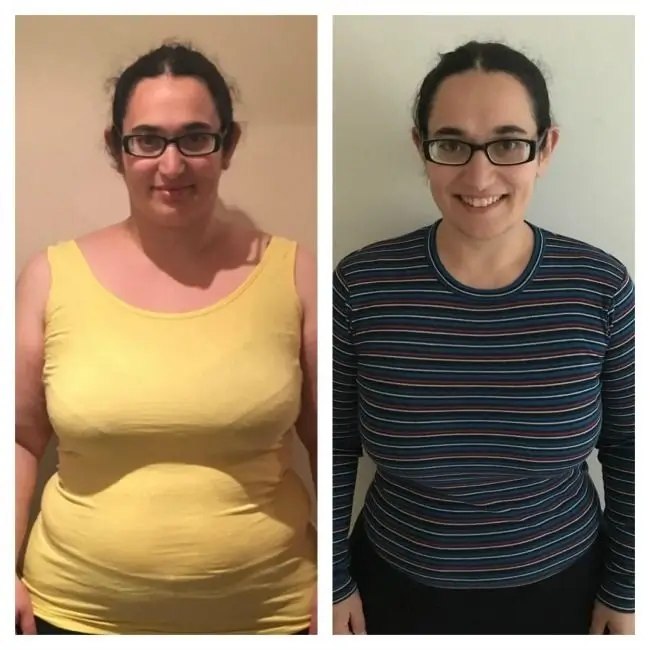 Before and After Lisa M